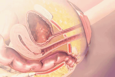 ��������һ����̥�и����ӹ����µ���