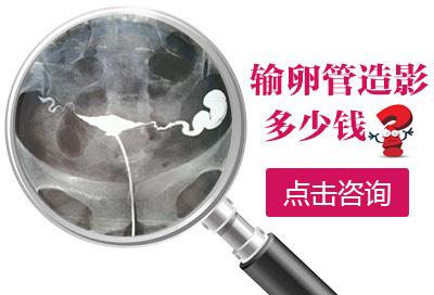 �����������ѹ���Ӱ������Ǯ