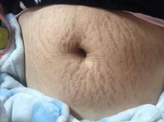 �������ȥ��������